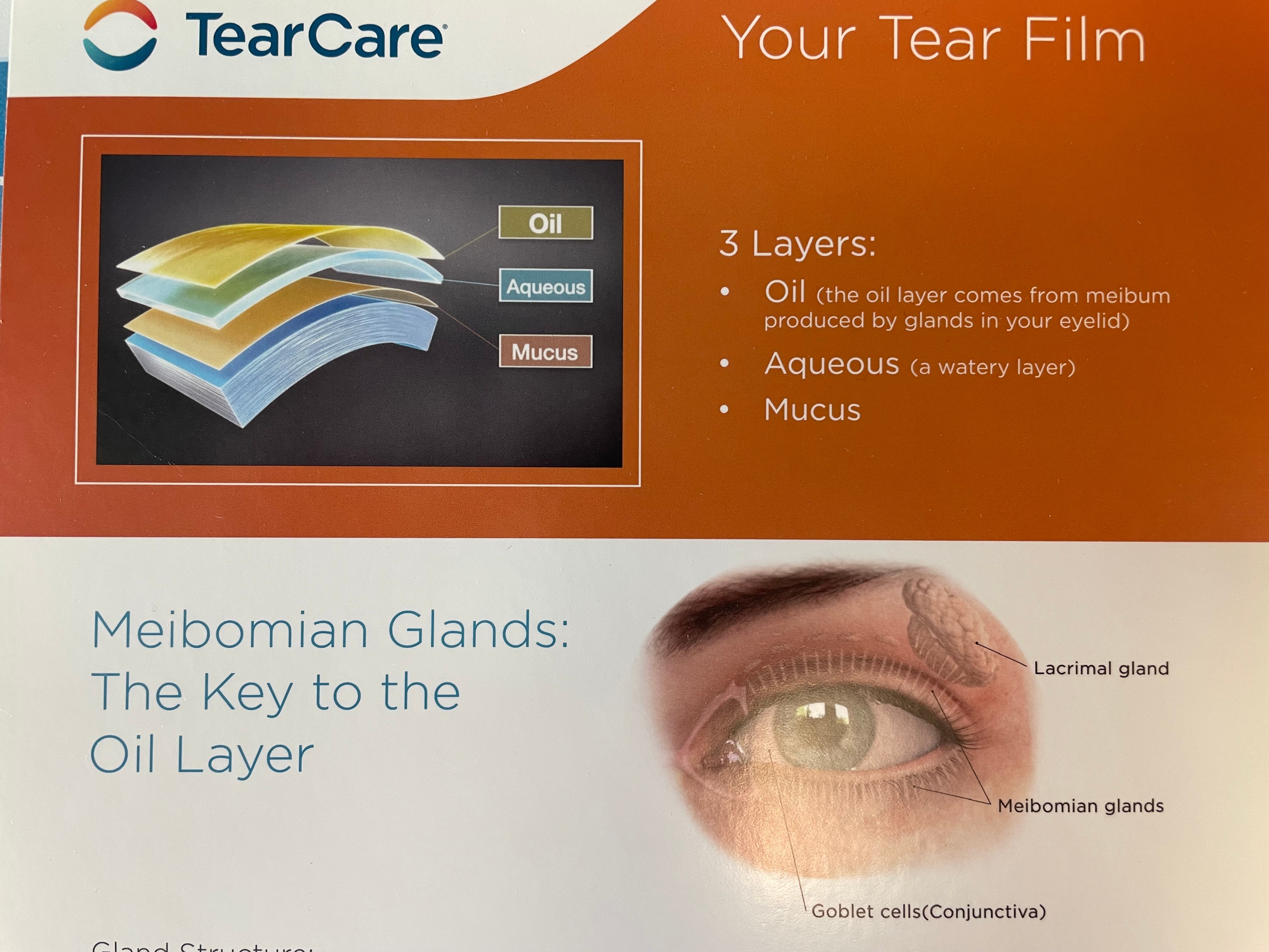 Dry Eyes and Bad Computer Vision - We Got This!!